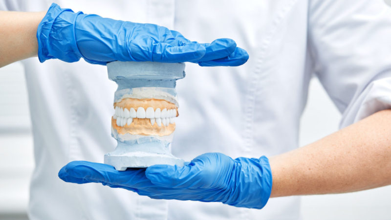 Profesjonalne leczenie protetyczne zębów – jak znaleźć najlepszy gabinet?